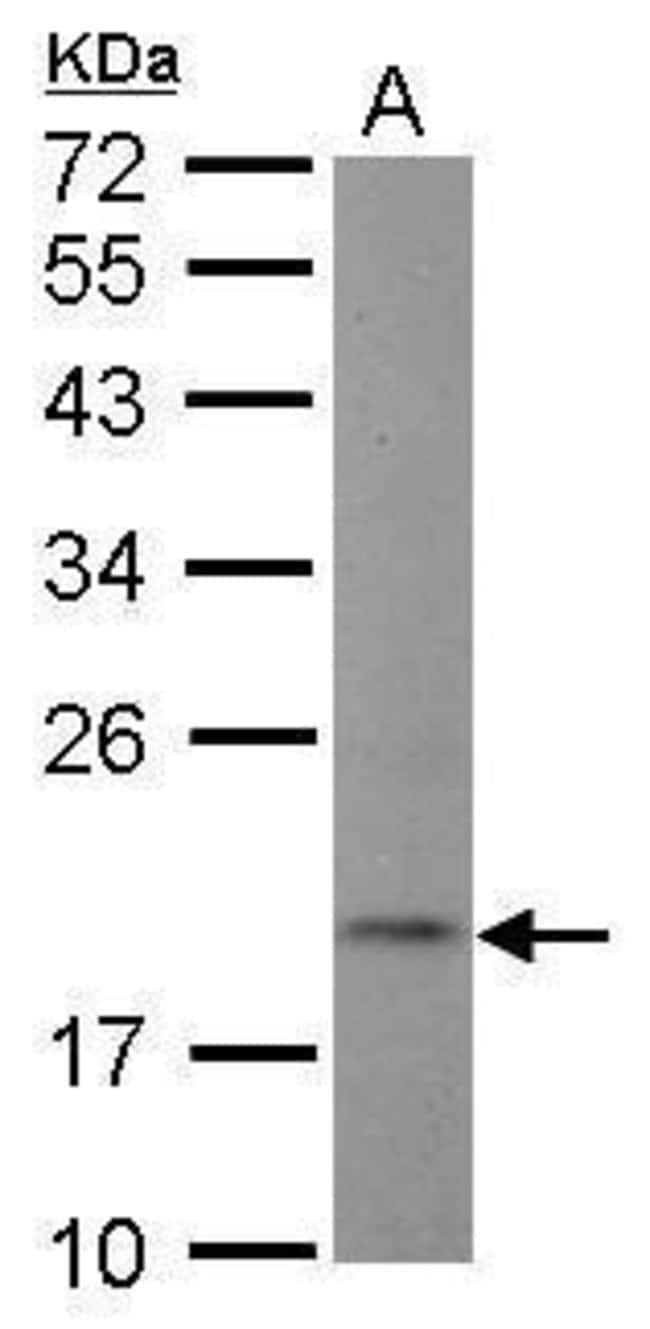 100uL Polyclonal antibody, NT5C, host ra