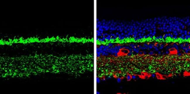 100uL Polyclonal antibody, complexin 3,