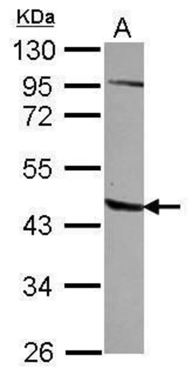 100uL Polyclonal antibody, AGPAT5, host