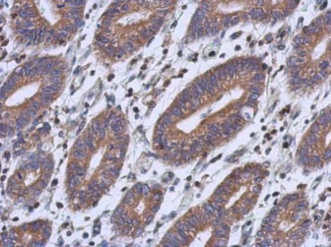 100uL Polyclonal antibody, RFESD, host r