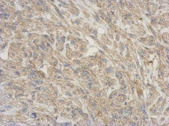 100uL Polyclonal antibody, RNASE11, host