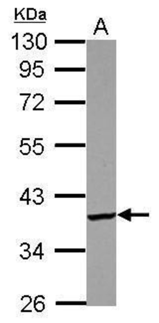 100uL Polyclonal antibody, PdiK1L, host
