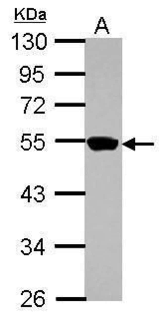 100uL Polyclonal antibody, ZNF597, host