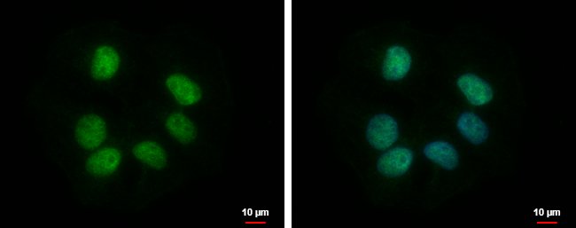100uL Polyclonal antibody, RBMY1F, host
