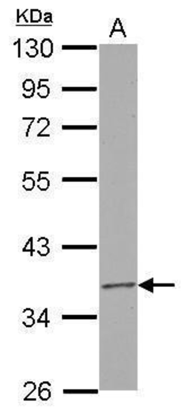 100uL Polyclonal antibody, RPUSD3, host