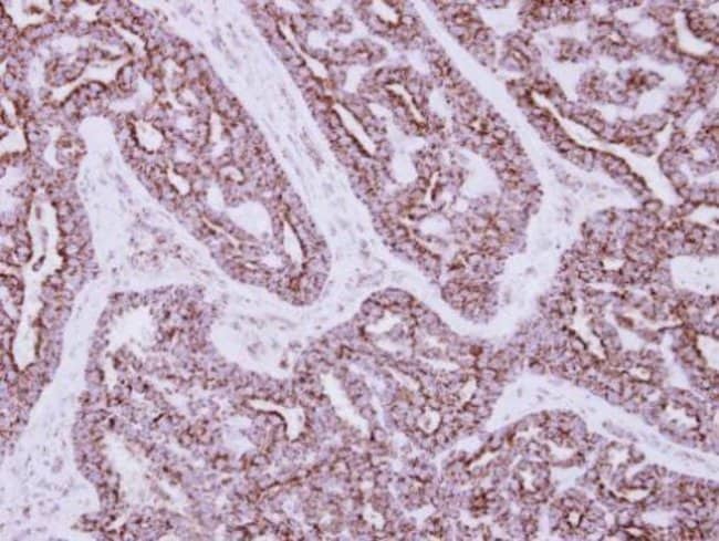 100uL Polyclonal antibody, HIBADH, host