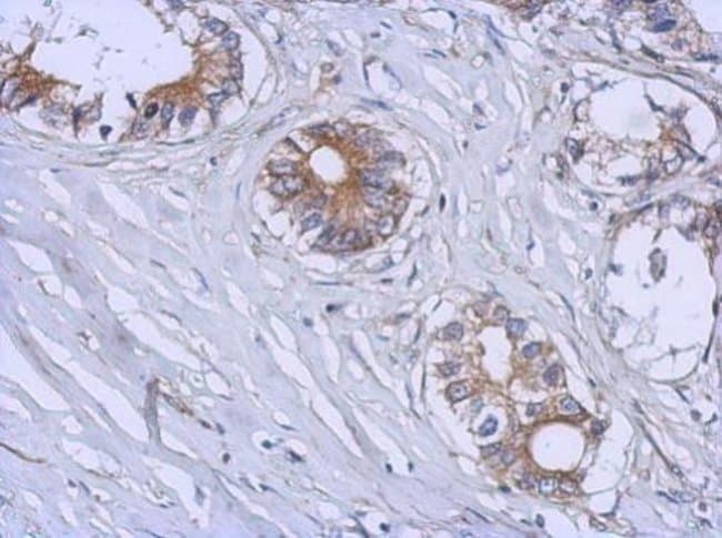 100uL Polyclonal antibody, B3GALT4, host