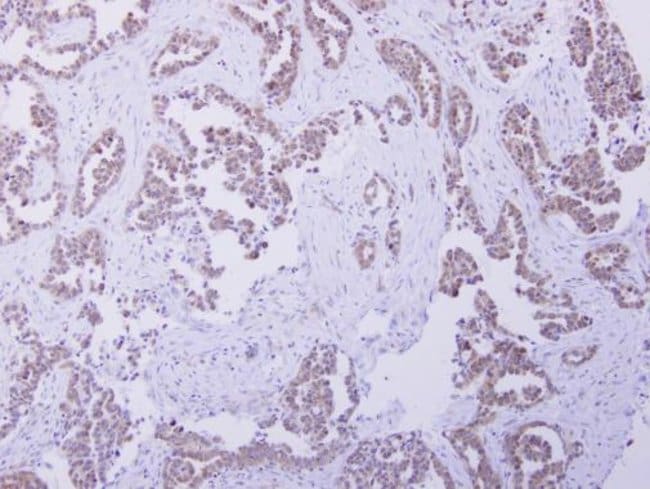 100uL Polyclonal antibody, CBR4, host ra