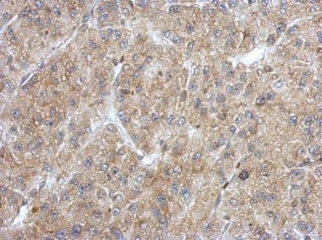 100uL Polyclonal antibody, ANKRD53, host