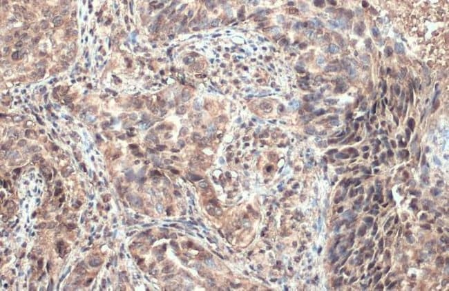 100uL Polyclonal antibody, ULBP1, host r