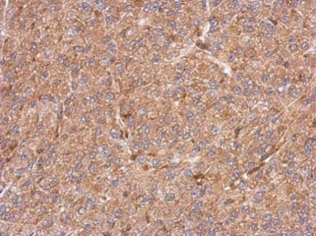 100uL Polyclonal antibody, CCDC105, host