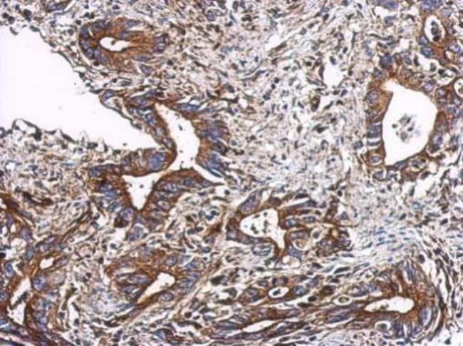 100uL Polyclonal antibody, TTC31, host r