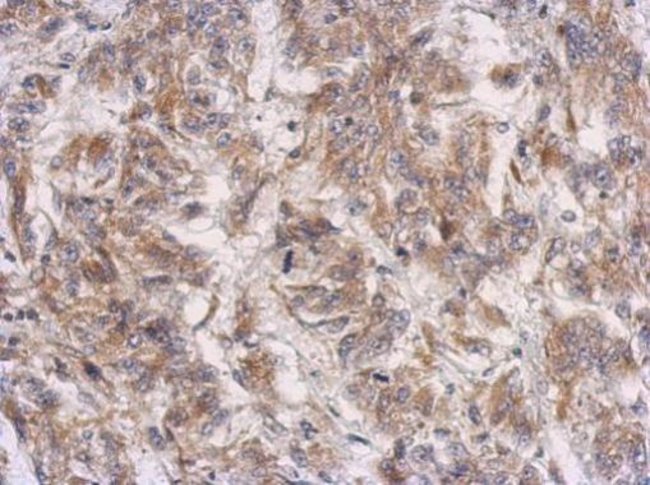 100uL Polyclonal antibody, PRSS35, host
