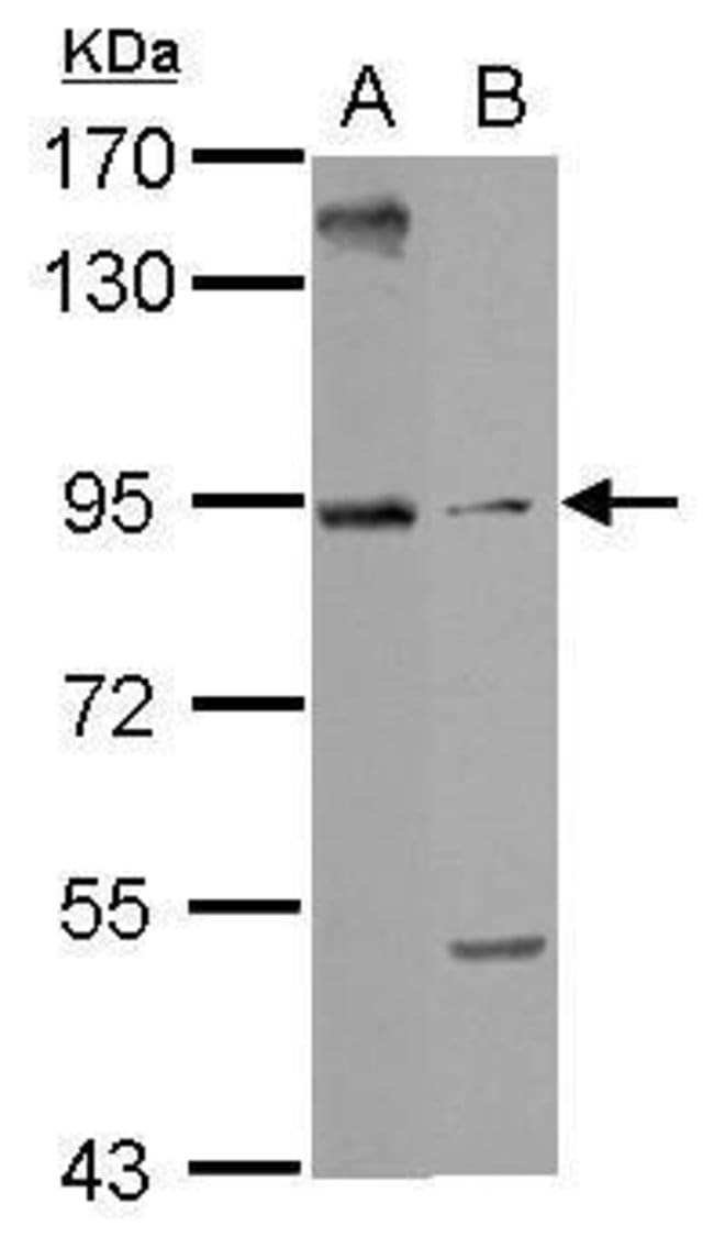 100uL Polyclonal antibody, ARMC3, host r