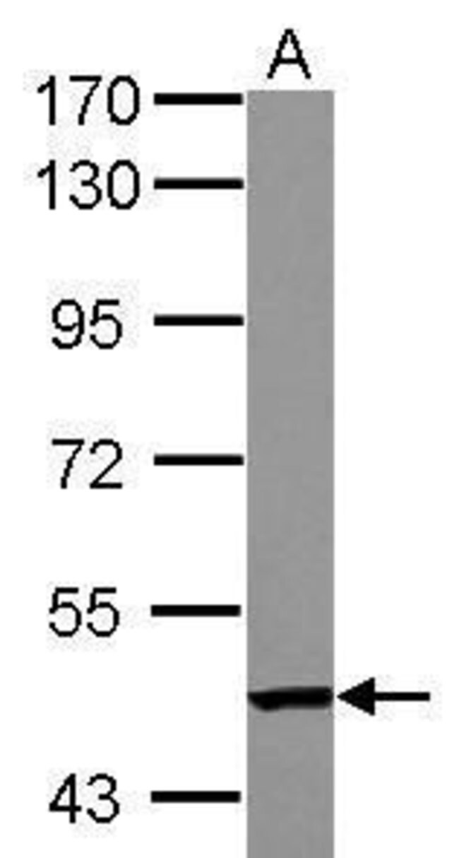100uL Polyclonal antibody, TC2N, host ra