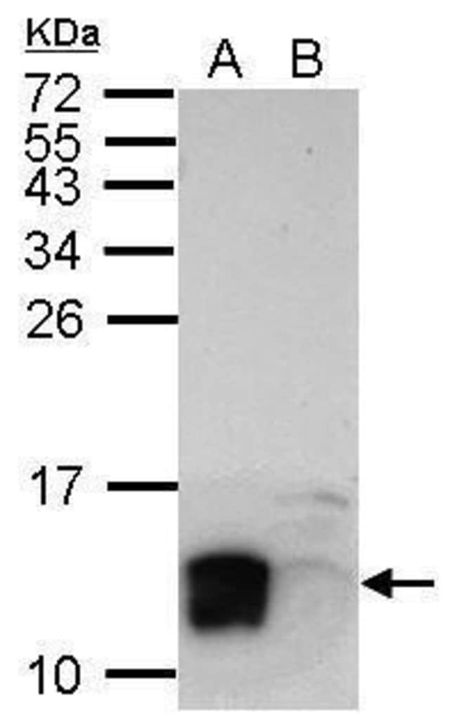 100uL Polyclonal antibody, LYPD6, host r
