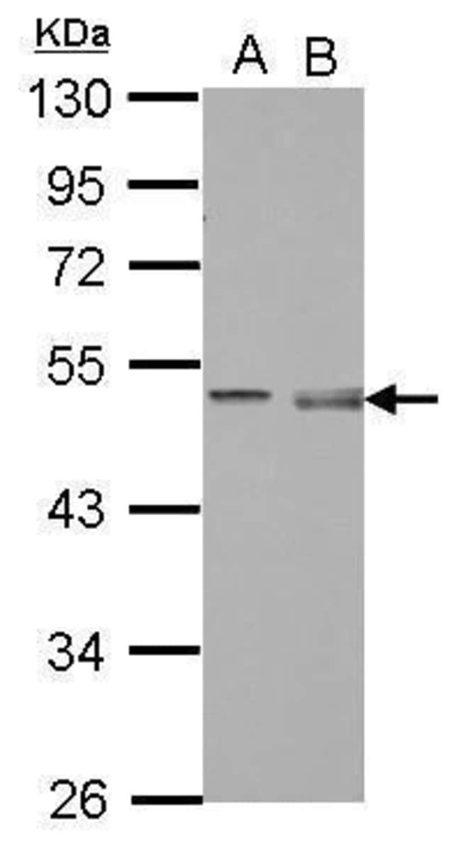 100uL Polyclonal antibody, pellino1, hos