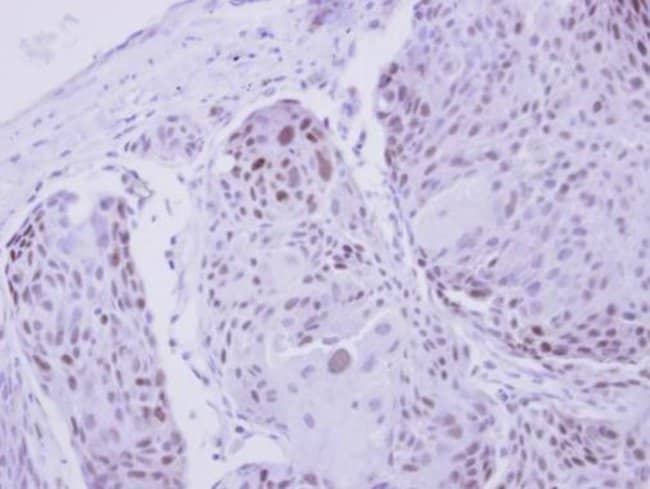 100uL Polyclonal antibody, ZNF530, host