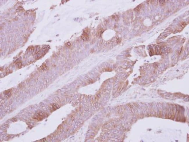 100uL Polyclonal antibody, atpalpha, hos