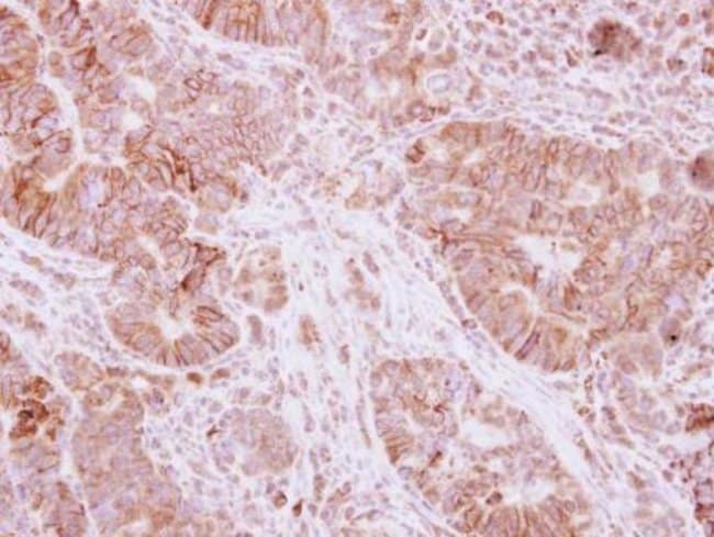 100uL Polyclonal antibody, atpalpha, hos
