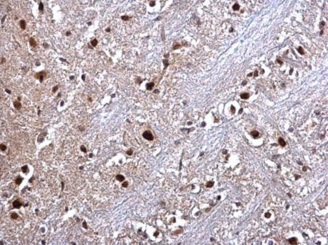 100uL Polyclonal antibody, RED, host rab