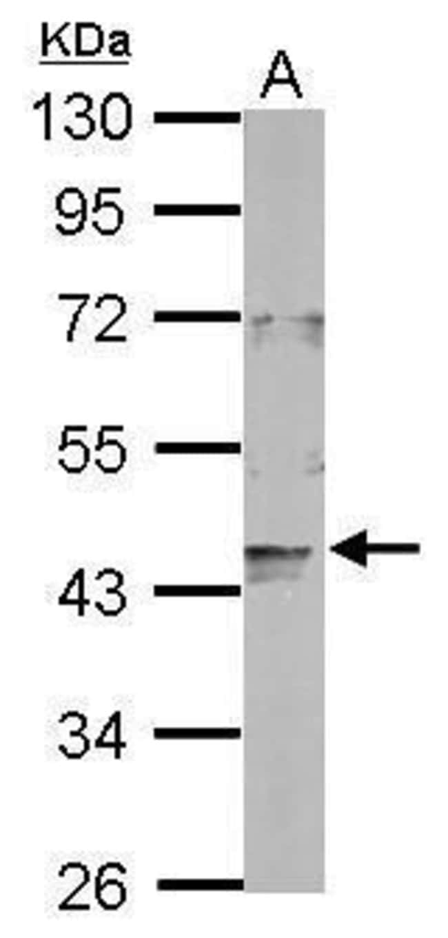100uL Polyclonal antibody, LONP2, host r