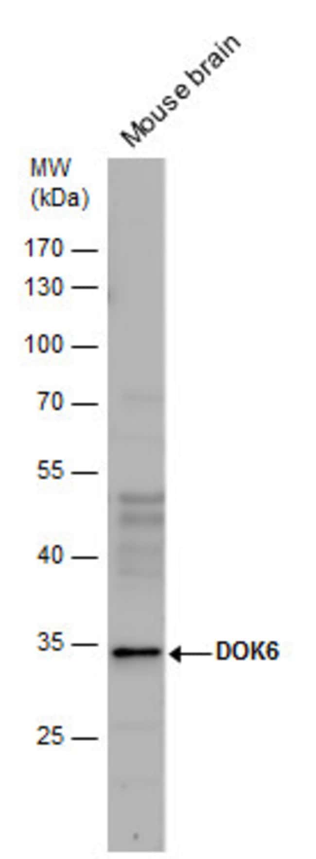 100uL Polyclonal antibody, DOK6, host ra