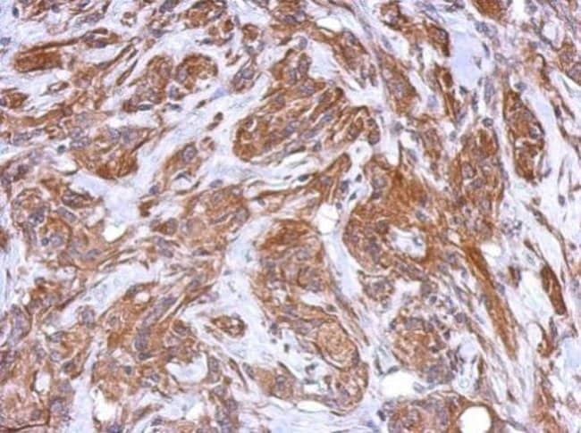100uL Polyclonal antibody, MRVI1, host r