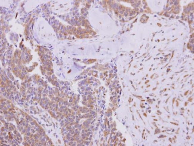 100uL Polyclonal antibody, KBTBD3, host