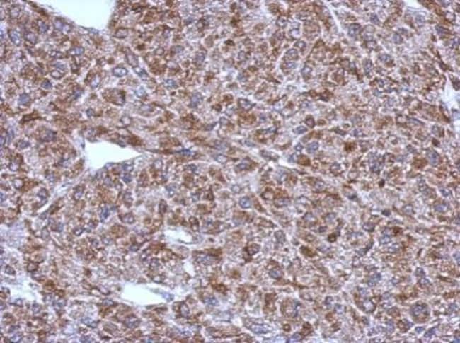 100uL ACSM1 Polyclonal Antibody, IHC (P)