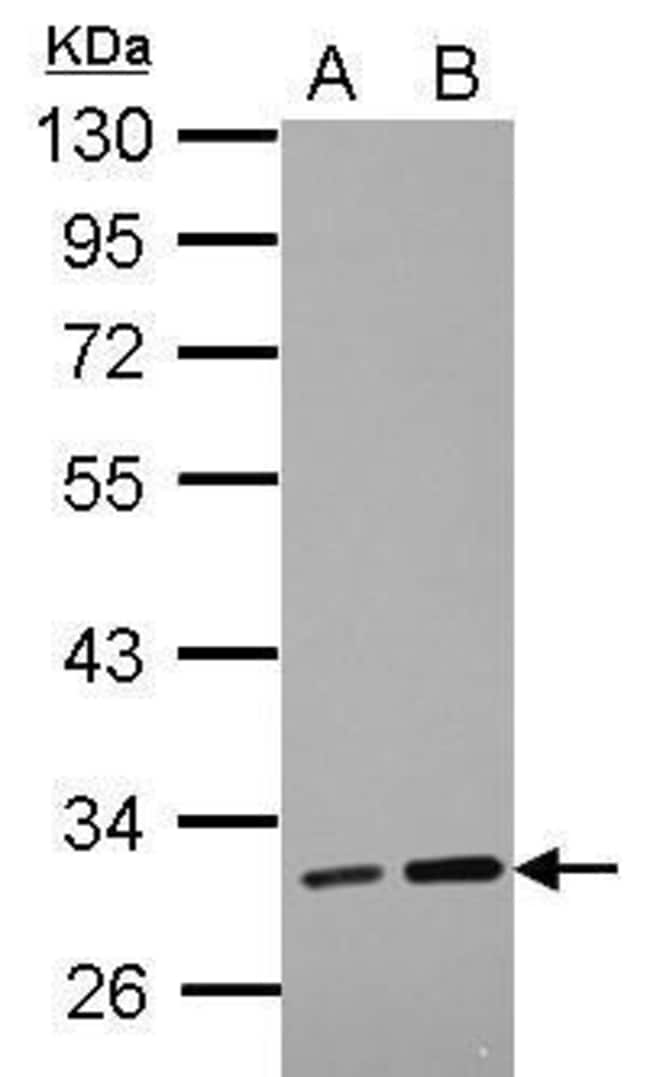 100uL Polyclonal antibody, LRRC19, host