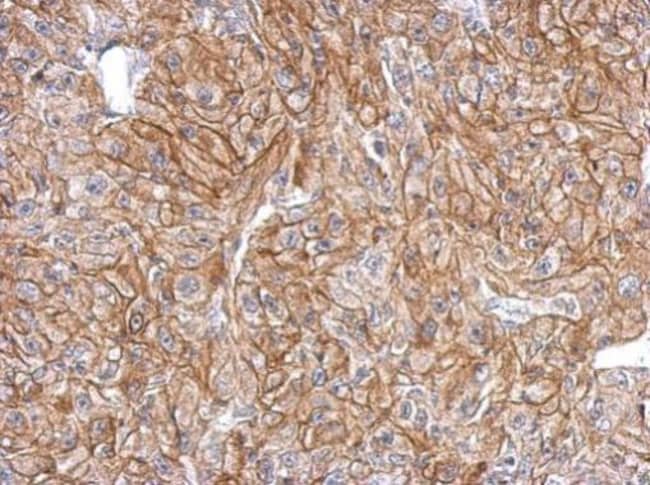 100uL Polyclonal antibody, FLRT2, host r