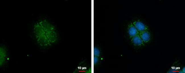 100uL Polyclonal antibody, GBAS, host ra