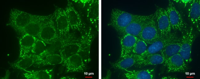 100uL Polyclonal antibody, DHRS2, host r