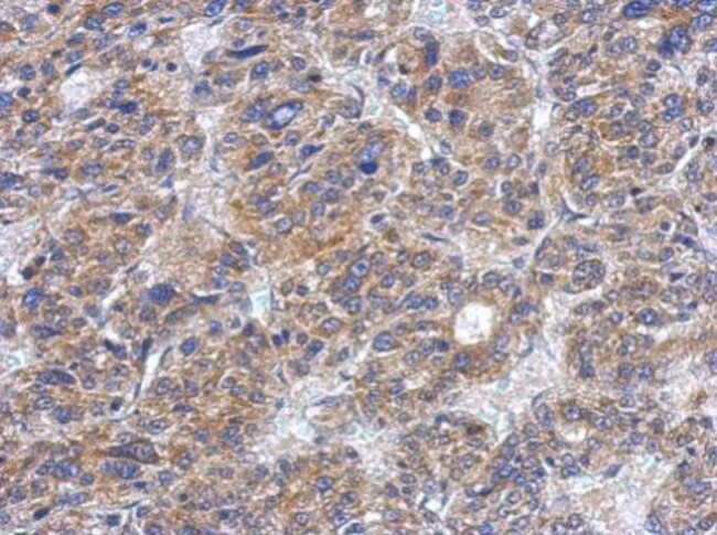100uL Polyclonal antibody, casein kinase