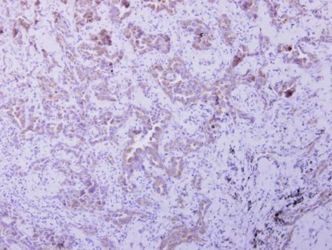 100uL Polyclonal antibody, OXSM, host ra