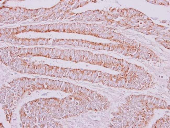 100uL Polyclonal antibody, OXSM, host ra