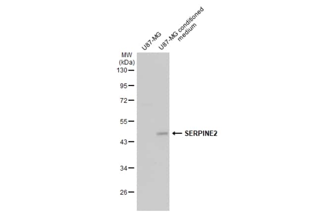 100uL Polyclonal antibody, SERPINE2, hos