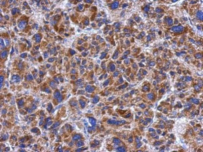 100uL Polyclonal antibody, TSARG2, host