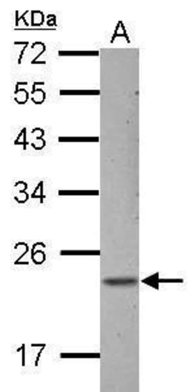 100uL Polyclonal antibody, ZNF22, host r