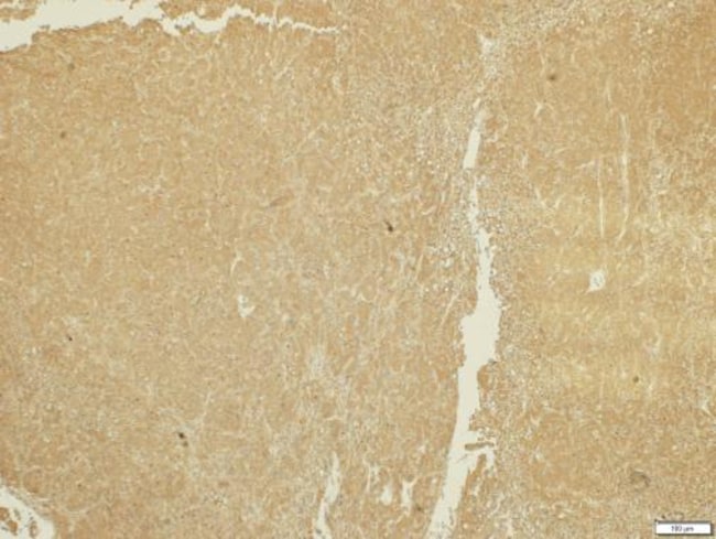 100uL Polyclonal antibody, ADAMTS5, host