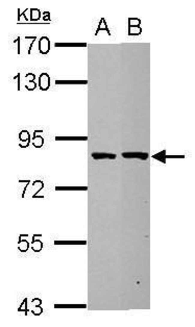 100uL Polyclonal antibody, ESRP2, host r