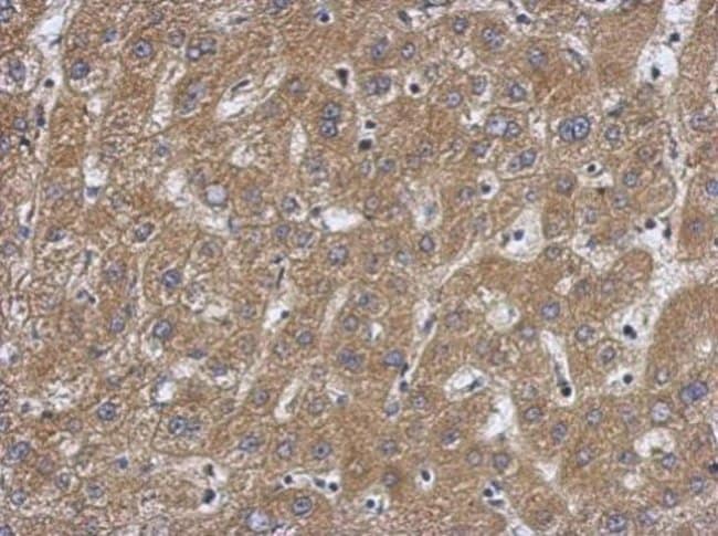 100uL Polyclonal antibody, caspase 7 p11