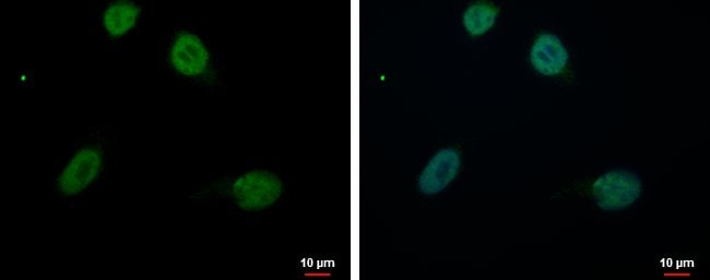 100uL Polyclonal antibody, RED, host rab
