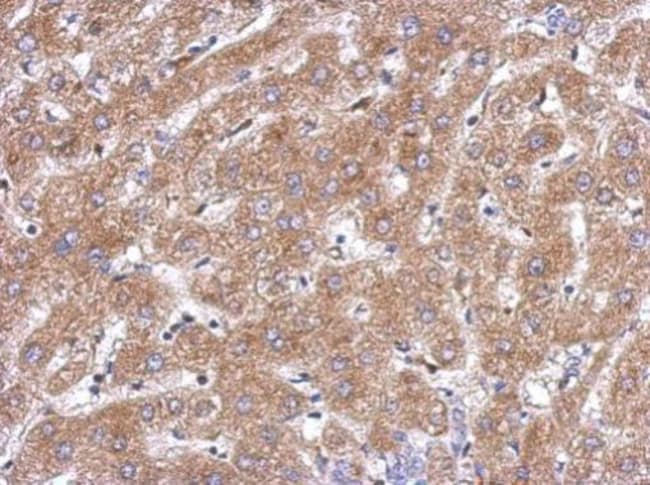 100uL Polyclonal antibody, ACOT12, host