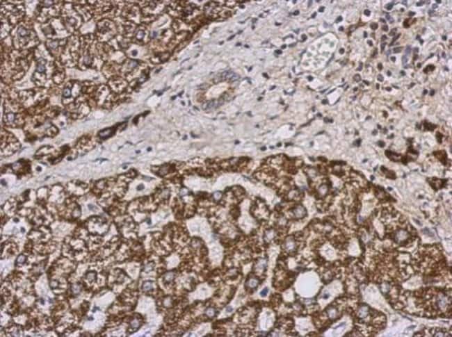 100uL Polyclonal antibody, PECI, host ra