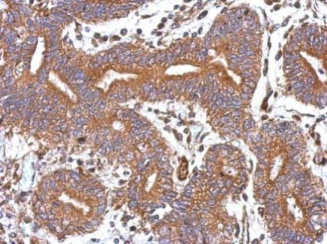 100uL Polyclonal antibody, GBAS, host ra