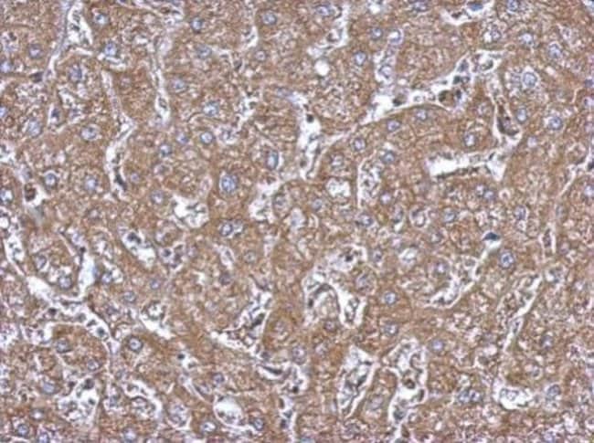 100uL Polyclonal antibody, ALDH1A1, host