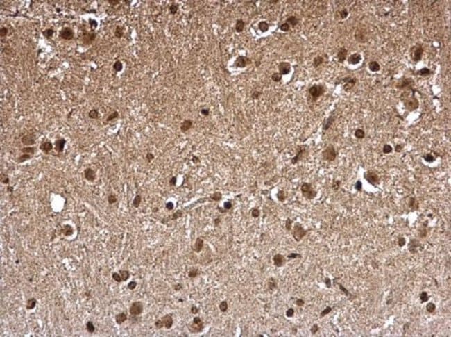 100uL Polyclonal antibody, FHL1, host ra
