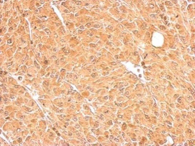 100uL Polyclonal antibody, GALM, host ra
